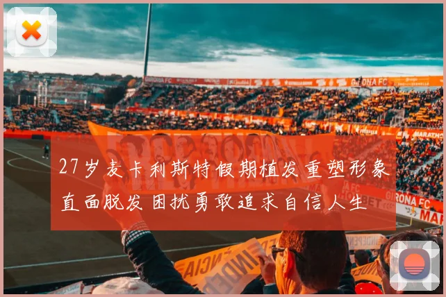 27岁麦卡利斯特假期植发重塑形象直面脱发困扰勇敢追求自信人生